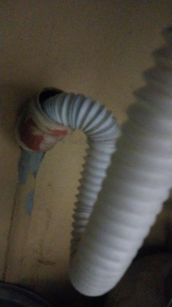 Lavabo gideri tıkanıklığı
